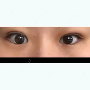 7 days after image