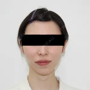 184 days after image