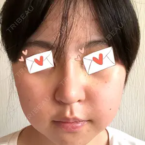 15 days after image