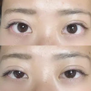 27 days after image
