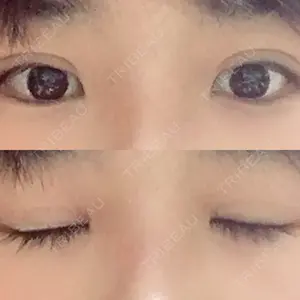 11 days after image
