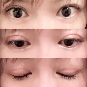 70 days after image