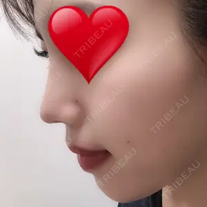46 days after image