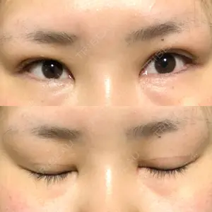 112 days after image