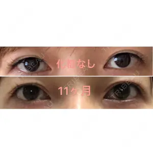 312 days after image
