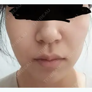 6 days after image
