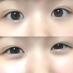 448 days after image
