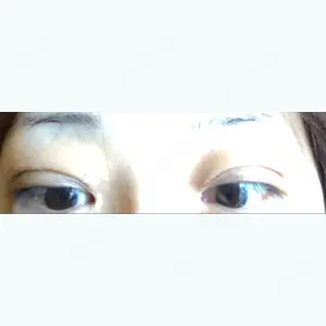 33 days after image