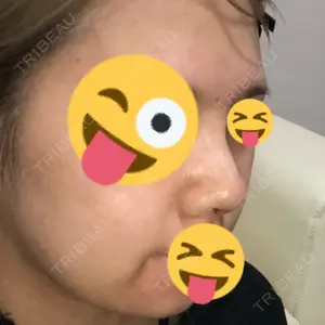 iSTAR美容外科・皮膚科口コミ