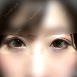 41 days after image