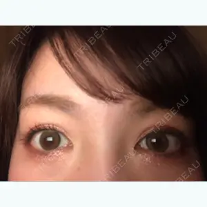 70 days after image