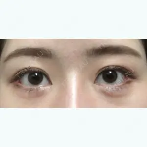 61 days after image