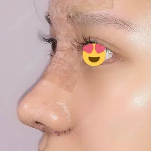 9 days after image