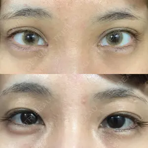 93 days after image