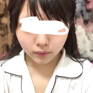 3 days after image