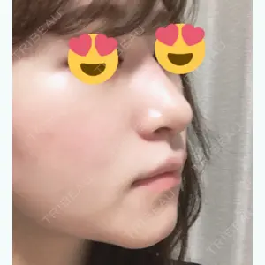 66 days after image