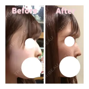 194 days after image