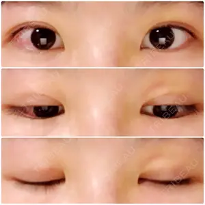 6 days after image