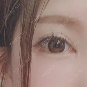 0 days after image