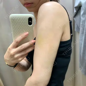 18 days after image