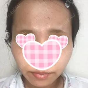 30 days after image