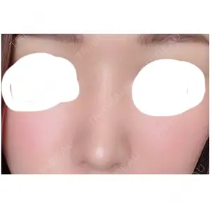 61 days after image