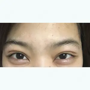 17 days after image