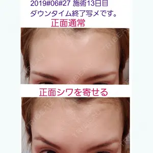 13 days after image