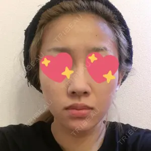 300 days after image