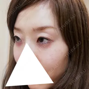 77 days after image