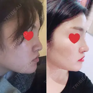 5 days after image
