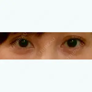 8 days after image
