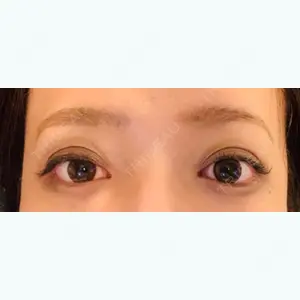 6 days after image