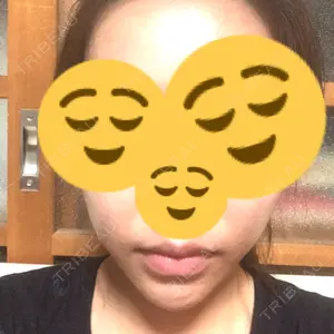 140 days after image