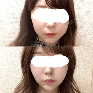 39 days after image