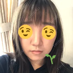 10 days after image