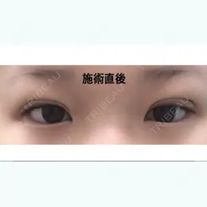 0 days after image