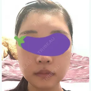 9 days after image