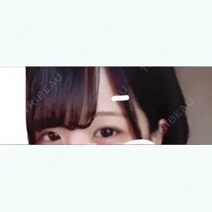 98 days after image