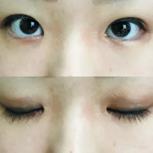 7 days after image