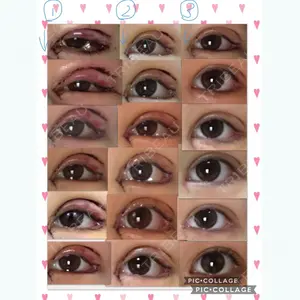 180 days after image