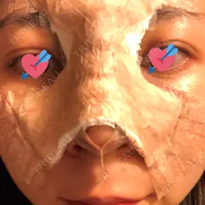 2 days after image