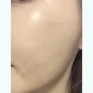 10 days after image