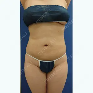 30 days after image