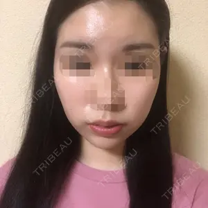 108 days after image