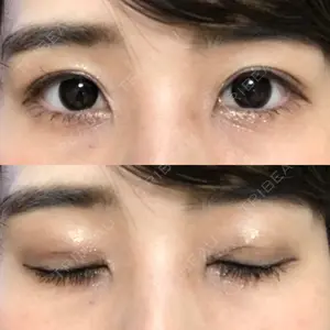36 days after image
