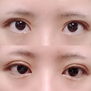 8 days after image