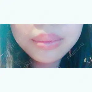 147 days after image