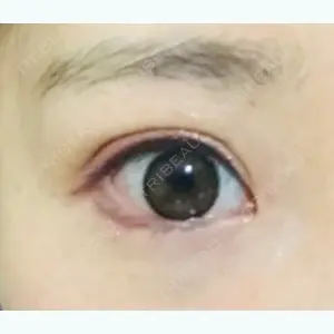 28 days after image