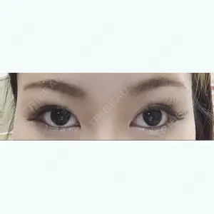 36 days after image